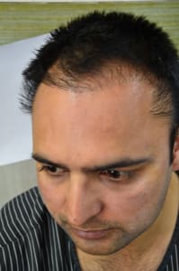 צמיחה דלה